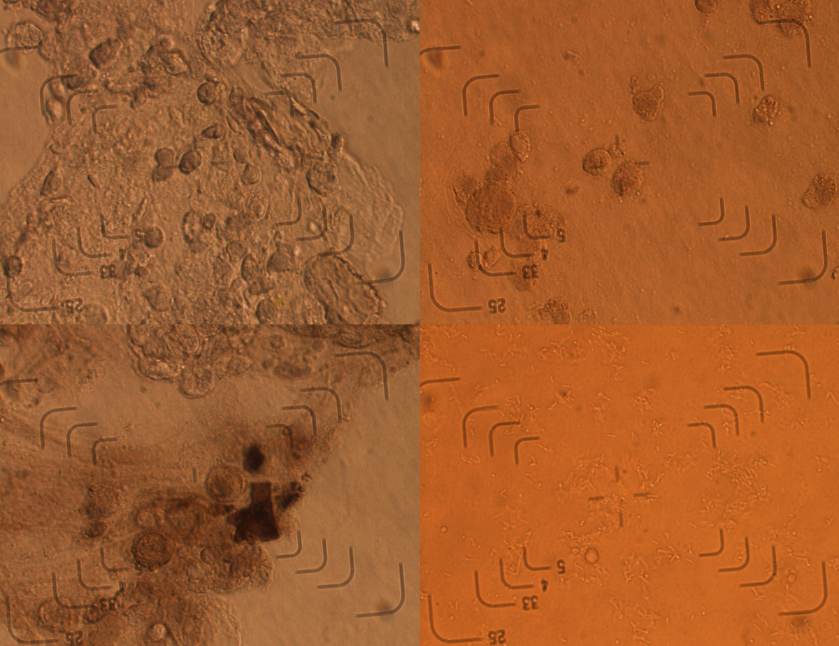 hematoxylin_mucous2