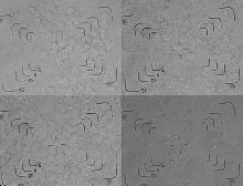 nasal mucous
