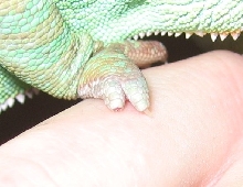 Missing Toenail