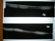 eggs xray