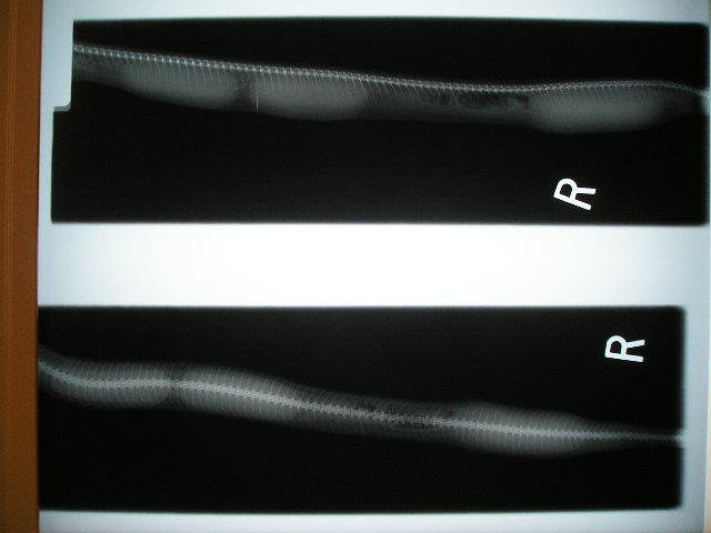 eggs xray