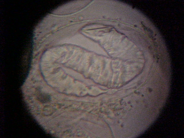 hookworm
