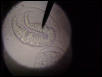 hookworm