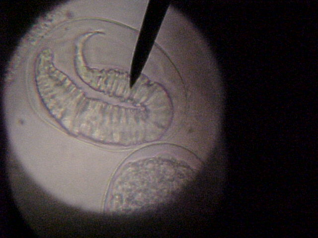 hookworm