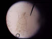 Pseudoparasitic mite